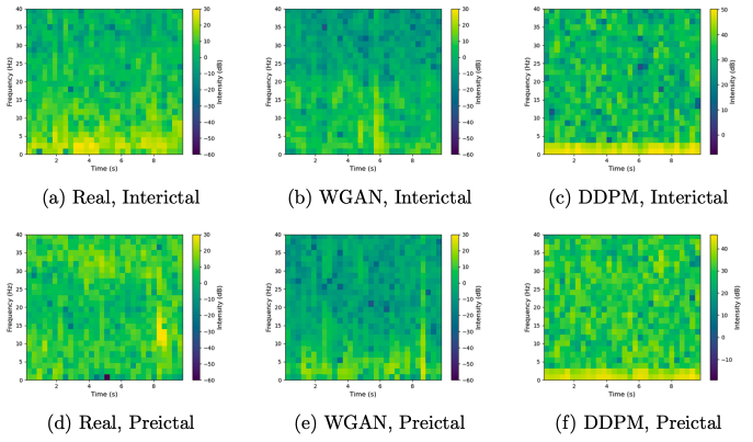 Synthetic iEEG Data Production for Epilepsy Analysis